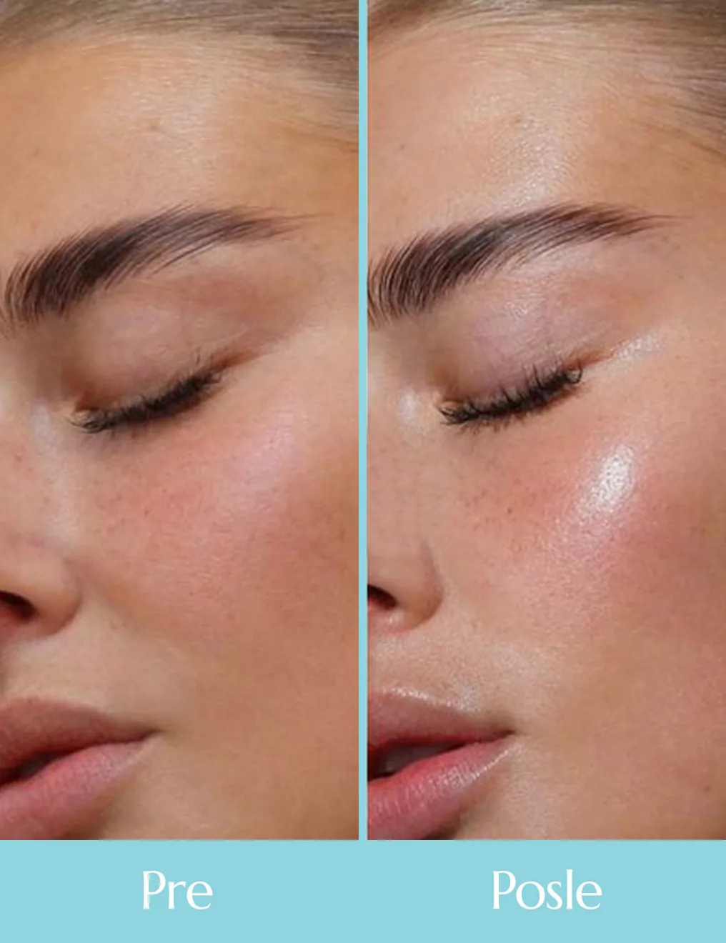 Ellyn Bio Colagen Mask